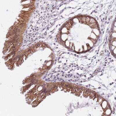 Immunohistochemistry-Paraffin: Kv1.5 Antibody [NBP2-33891]