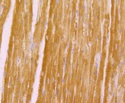 Immunohistochemistry-Paraffin: Kv1.5 Antibody [NBP2-76939]