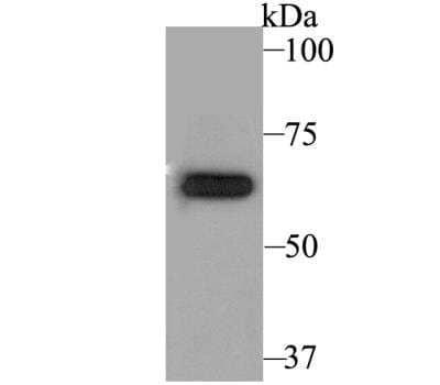 Western Blot: Kv1.5 Antibody [NBP2-76939]