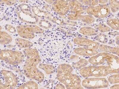 Immunohistochemistry-Paraffin: Kv1.6 Antibody [NBP2-98145]