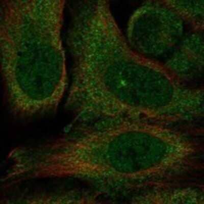 Immunocytochemistry/ Immunofluorescence: Kv10.2 Antibody [NBP3-17509]