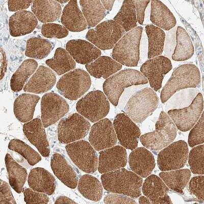 Immunohistochemistry-Paraffin: Kv10.2 Antibody [NBP1-84934]