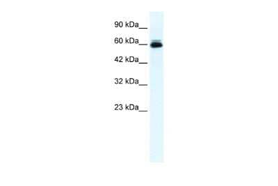 Western Blot: Kv10.2 Antibody [NBP2-83132]