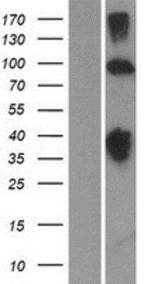 Western Blot: Kv11.1 Overexpression Lysate [NBP2-10603]