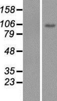 Western Blot: Kv11.2 Overexpression Lysate [NBP2-05155]