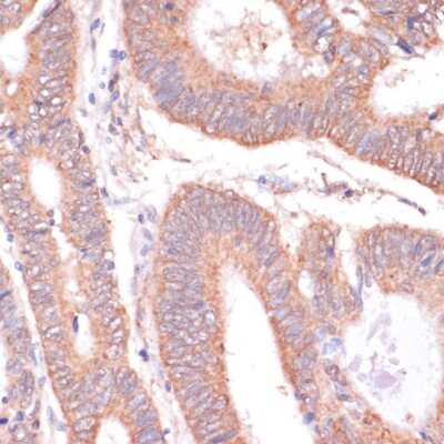 Immunohistochemistry-Paraffin: Kv11.1 Antibody - Azide and BSA Free [NBP3-03109]