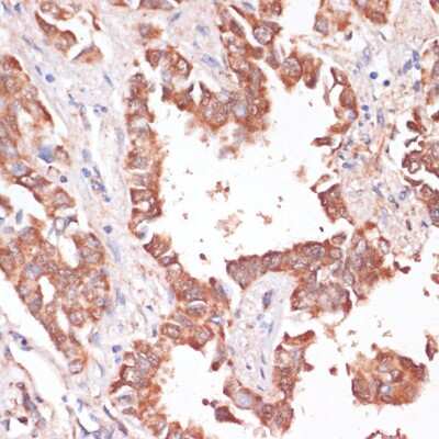 Immunohistochemistry-Paraffin: Kv11.1 Antibody - Azide and BSA Free [NBP3-03109]