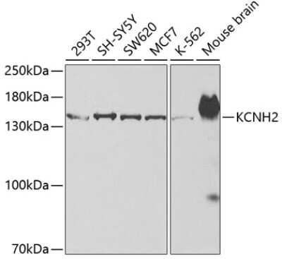 Western Blot: Kv11.1 AntibodyAzide and BSA Free [NBP3-03109]