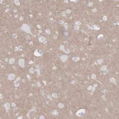 Immunohistochemistry-Paraffin: Kv11.2 Antibody [NBP3-17875]