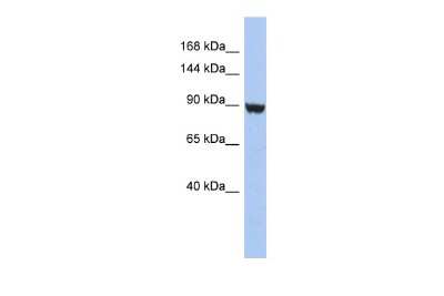 Western Blot: Kv11.2 Antibody [NBP2-84124]