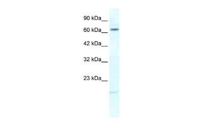 Western Blot: Kv11.2 Antibody [NBP2-84125]