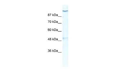 Western Blot: Kv11.2 Antibody [NBP2-84126]