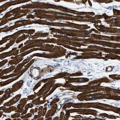 Immunohistochemistry-Paraffin: Kv11.3 Antibody [NBP1-84813]