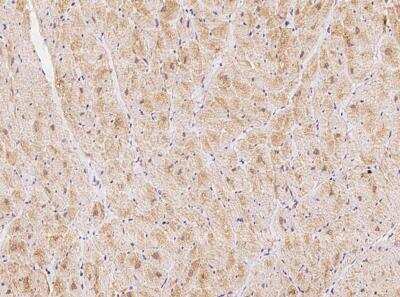 Immunohistochemistry-Paraffin: Kv11.3 Antibody [NBP3-06083]