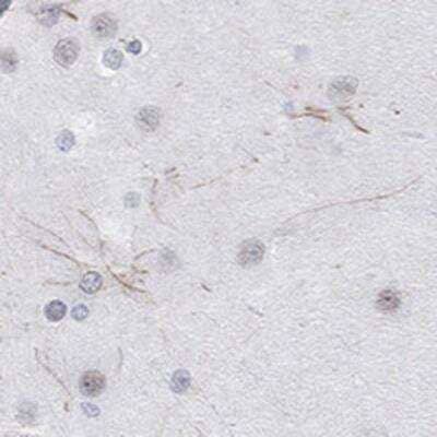 Immunohistochemistry-Paraffin: Kv12.1 Antibody [NBP3-17510]