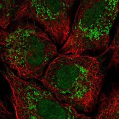 Immunocytochemistry/ Immunofluorescence: Kv12.2 Antibody [NBP2-14142]