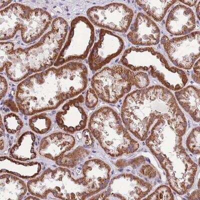 Immunohistochemistry-Paraffin: Kv12.2 Antibody [NBP2-14142]