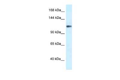 Western Blot: Kv12.2 Antibody [NBP2-85185]