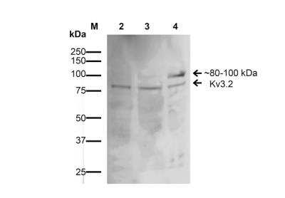 Western Blot: Kv3.2 Antibody (S410-17) [NBP2-59328]