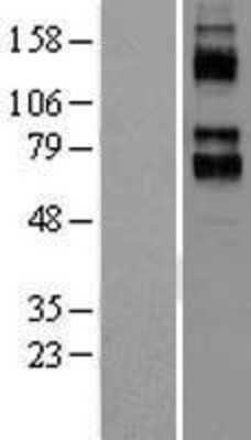 Western Blot: Kv3.4 Overexpression Lysate [NBL1-12144]