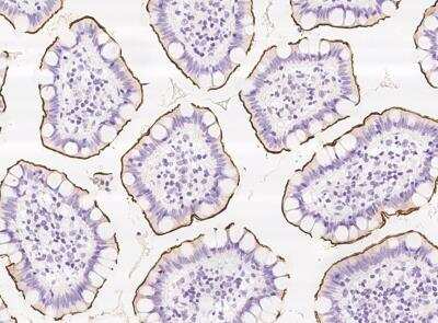 Immunohistochemistry-Paraffin: Kv3.3 Antibody [NBP3-05792]