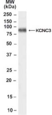 Western Blot: Kv3.3 Antibody [NB100-58961]