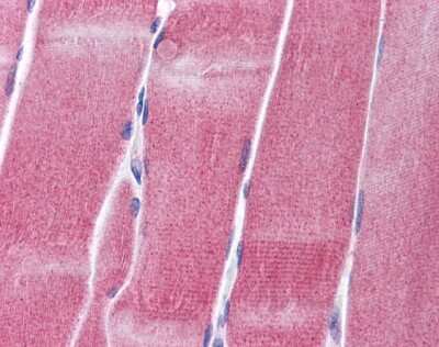 Immunohistochemistry: Kv3.4 Antibody [NBP2-85189]