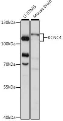 Western Blot: Kv3.4 AntibodyAzide and BSA Free [NBP3-03745]