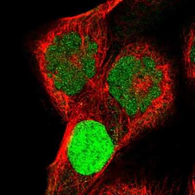 Immunocytochemistry/ Immunofluorescence: Kv4.1 Antibody [NBP2-55128]