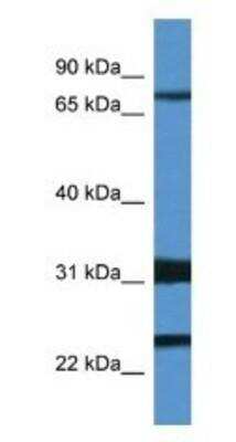 Western Blot: Kv4.1 Antibody [NBP1-74103]