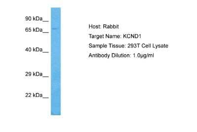 Western Blot: Kv4.1 Antibody [NBP2-87705]