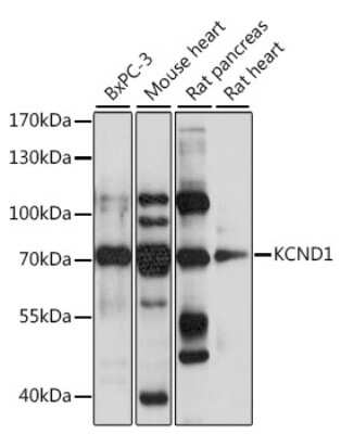 Western Blot: Kv4.1 AntibodyBSA Free [NBP3-03744]