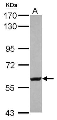 Western Blot: Kv4.2 Antibody [NBP2-19314]