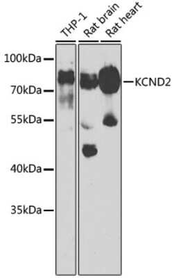 Western Blot: Kv4.2 AntibodyBSA Free [NBP3-03748]