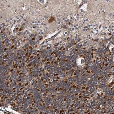 Immunohistochemistry-Paraffin: Kv4.3 Antibody [NBP1-82864]