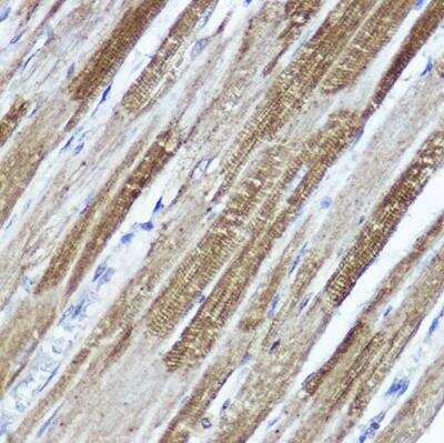 Immunohistochemistry-Paraffin: Kv4.3 Antibody - Azide and BSA Free [NBP3-03750]