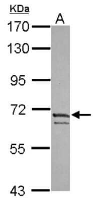 Western Blot: Kv4.3 Antibody [NBP2-19315]