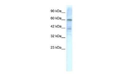 Western Blot: Kv4.3 Antibody [NBP2-87707]