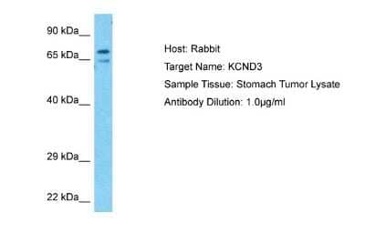 Western Blot: Kv4.3 Antibody [NBP2-87708]