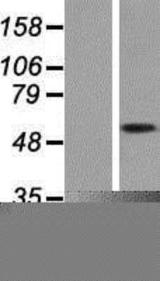 Western Blot: Kv5.1 Overexpression Lysate [NBP2-08135]