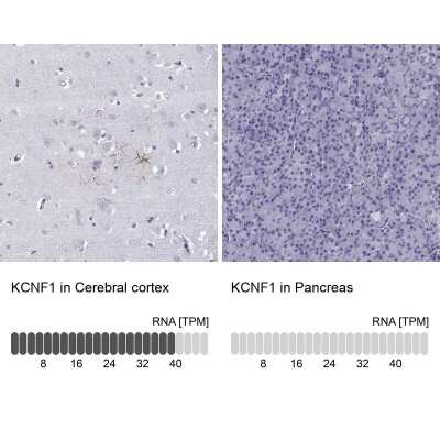 Immunohistochemistry-Paraffin: Kv5.1 Antibody [NBP2-62639]