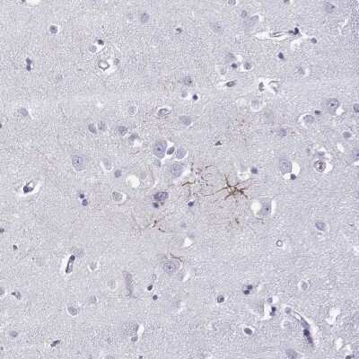 Immunohistochemistry-Paraffin: Kv5.1 Antibody [NBP2-62639]