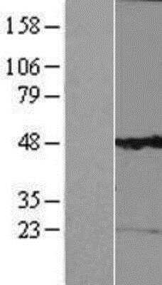 Western Blot: Kv6.1 Overexpression Lysate [NBP2-08136]