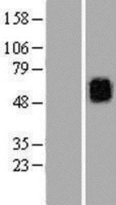 Western Blot: Kv6.3 Overexpression Lysate [NBP2-05160]