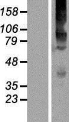 Western Blot: Kv6.4 Overexpression Lysate [NBP2-05161]