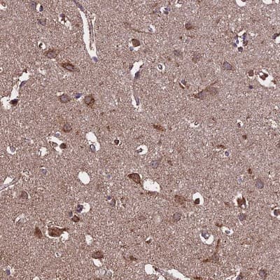 Immunohistochemistry-Paraffin: Kv6.1 Antibody [NBP1-81572]