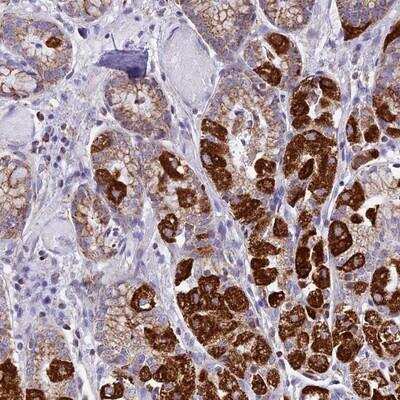 Immunohistochemistry-Paraffin: Kv6.1 Antibody [NBP1-81573]