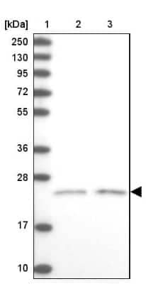 Western Blot: Kv6.1 Antibody [NBP1-81572]