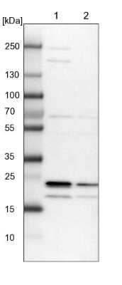 Western Blot: Kv6.1 Antibody [NBP1-81572]