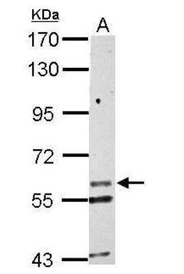 Western Blot: Kv6.1 Antibody [NBP2-17027]